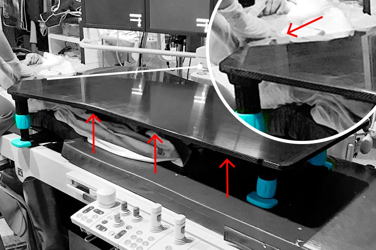 Adept Medical Retrograde IR Platform showing tapered edge near femoral artery access