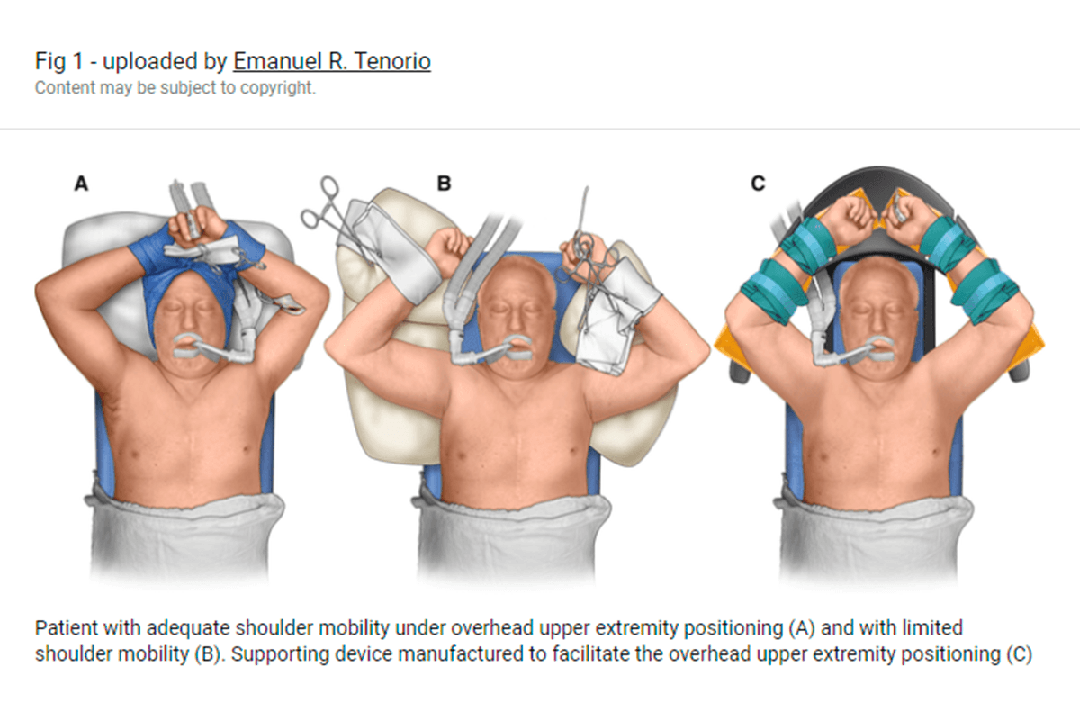 Safety evaluation of overhead upper extremity positioning to optimise imaging for FB-EVAR